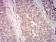 WDFY3 Primary Antibody  MP31720 [M2F7C2]