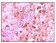 S100A6 Primary Antibody MP20054 [M7D11]