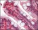 RSK1 Primary Antibody MP20136 [M10B1D7A9]