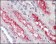 FER Primary Antibody MP20152 [M5D2C4]