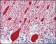 AMACR Primary Antibody MP20155 [M2A10F3]