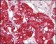 STYK1 Primary Antibody MP20168 [M2H2F10]