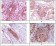Rab25 Primary Antibody MP20046 [M3F12F3]