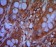 CHD3 Primary Antibody MP20422 [M2G4]