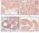 Cytokeratin (Pan) Primary Antibody MP20143 [M7H8C4]