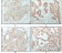 Cytokeratin 8 Primary Antibody MP20280 [M8A5D12]