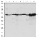 CARM1 Primary Antibody MP30153 [M3H2]