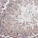 Anti-BCHE / Cholinesterase Antibody MX-C331478