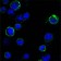 ROR1 Primary Antibody MP20372 [M2H6]
