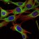 ABL2 Primary Antibody MP20429 [M1H1]