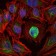 MMP1 Primary Antibody MP30236 [M6A5]