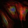 MMP9 Primary Antibody MP30251 [M5G3]