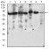 RPS6KA2 Primary Antibody MP30694 [M3C4C8]