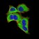 GLI1 Primary Antibody MP30831 [M1B9F8]
