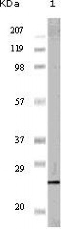 PR Primary Antibody MP20107 [M2F12B4]