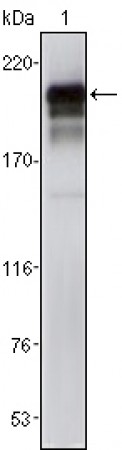 PDGFR Primary Antibody MP20358 [M1A2]