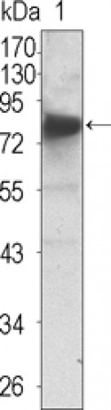 NTRK3 Primary Antibody MP20377 [M7H6]