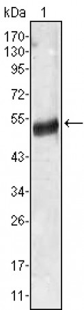 AGT Primary Antibody MP20360 [M1B1]