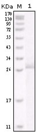HER-2 Primary Antibody MP20127 [M9B9D8]