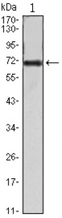 FAK Primary Antibody MP30053 [M10H7E9]