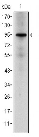 NR3C1 Primary Antibody MP30158 [M6E6]