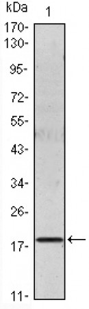 IL-6 Primary Antibody MP20021 [M6D9A1]