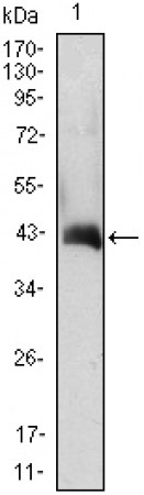 CSF2 Primary Antibody MP30023 [M3D3]