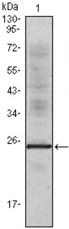 IL-1a Primary Antibody MP20010 [M3A6F11]
