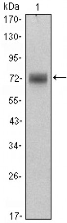 ZBTB16 Primary Antibody MP30076 [M5B3]