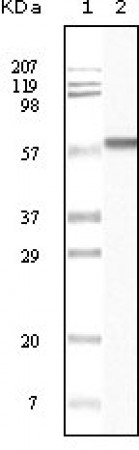 CK1 Primary Antibody MP20088 [M3C10F7]