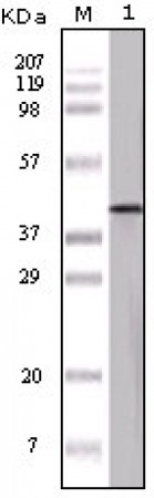 OVA Primary Antibody MP20095 [M3G2E1D9; 3D5F4A8; 3G1E1D9]