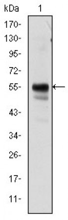 RUNX1 Primary Antibody MP30171 [M5A1]