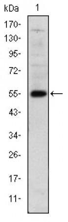 LHX2 Primary Antibody MP30191 [M6G2]