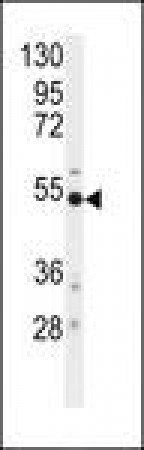 Anti-BACE1 / BACE Antibody (Ser498) MX-C96708