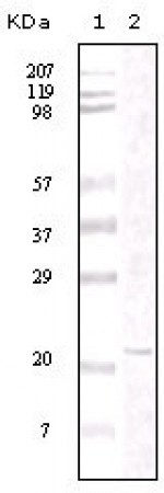 FAK Primary Antibody MP20065 [M4A9D6]