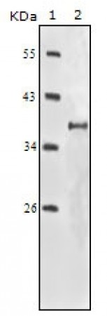 IGF1R-Beta Primary Antibody MP20138 [M3C8B1]
