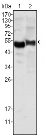AAT Primary Antibody MP20350 [M2B12]