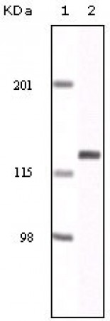 EphA2 Primary Antibody MP20071 [M1B3C7]