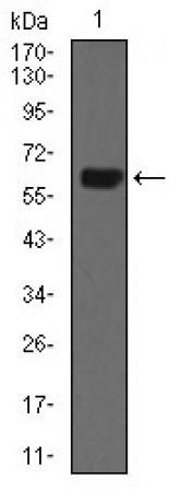 CK5 Primary Antibody MP30468P  [M10C11E6]