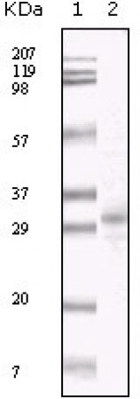 KSHV ORF26 Primary Antibody MP20036 [M2F6B8]