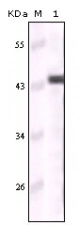 Cytokeratin 5 Primary Antibody MP20142 [M3E2F1]