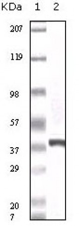 S100A6 Primary Antibody MP20054 [M7D11]