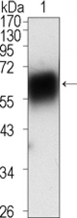 ROR1 Primary Antibody MP20372 [M2H6]