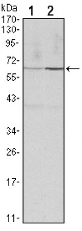 CCNB1 Primary Antibody MP30124 [M5G6]