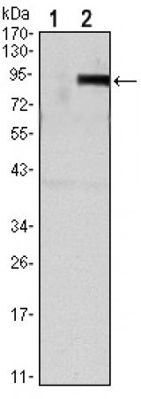 TNFRSF11B Primary Antibody MP30125 [M5G2]