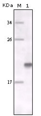 MER Primary Antibody MP20153 [M7E5G1]