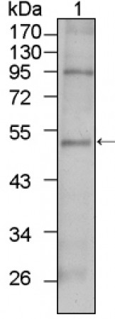 TBX5 Primary Antibody MP20355 [M7B11]