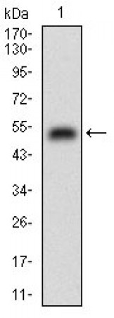 CSF1R Primary Antibody MP30594 [M6B9H2]