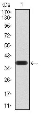 PPARA Primary Antibody MP30857 [M5D10E10]
