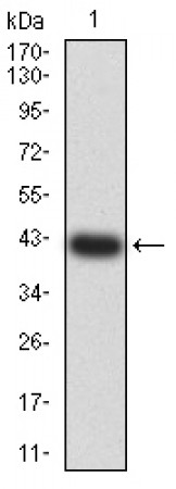 GRIK3 Primary Antibody MP31292 [M2B4H1]